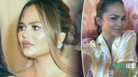 Uh Oh Chrissy Teigen in Hot Water Again? Cyberbullying Accusations and a Cheek Filler Rant!